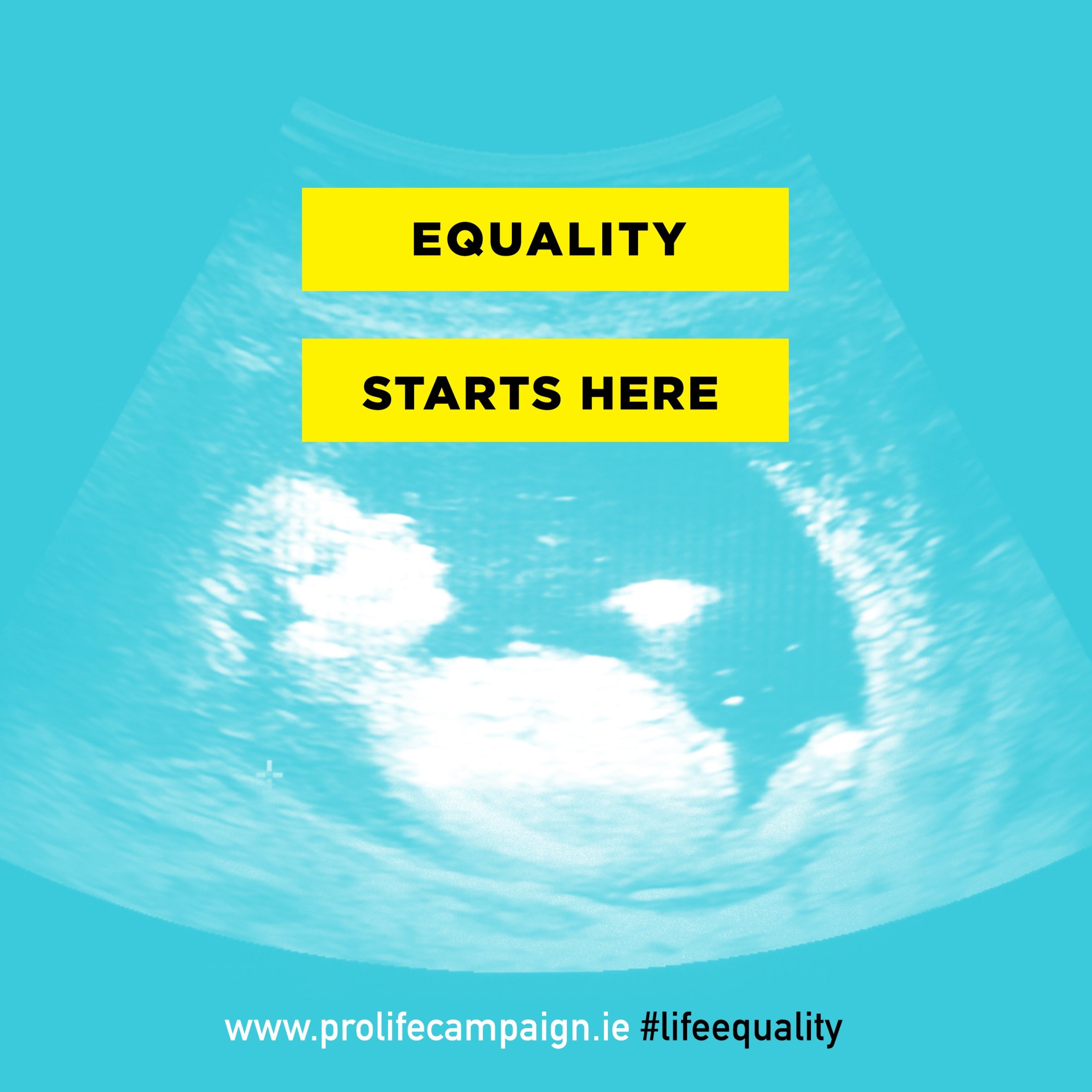 What happens when abortions go wrong?