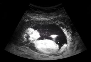 ultrasound film