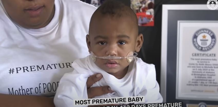19.11.2021 – Curtis is Guinness World Records ‘Most Premature Baby’!
