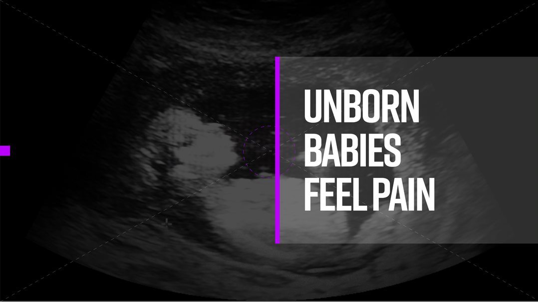 4.2.2022 – Unborn babies may feel pain as early as 8 weeks according to new peer-reviewed report