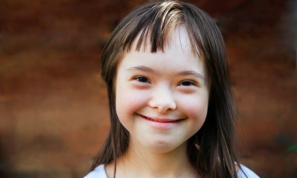 Why Down syndrome in Iceland has almost disappeared - CBS News