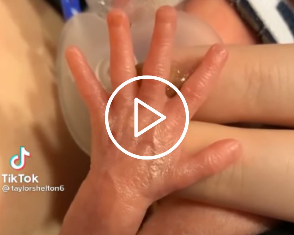 3.2.2023 – Premature Baby Stretches Out Hand to Person Caring for Him!