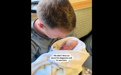 22.3.24: Marking World Down Syndrome Day