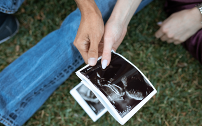 Scotland’s abortion numbers reach highest level ever recorded