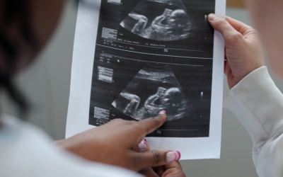 Government gifts €50 million to international pro-abortion group, not a cent to life-affirming alternatives at home