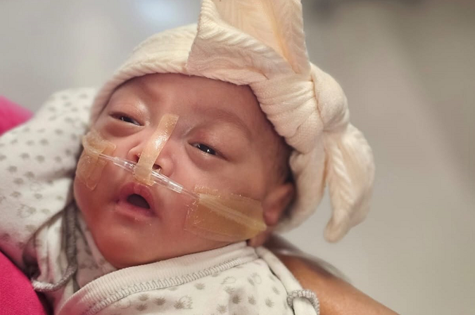 Born at 22 Weeks, baby girl makes history